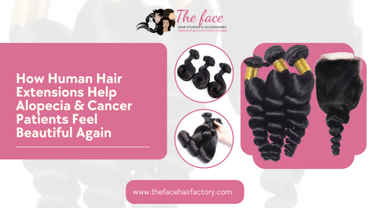 How Human Hair Extensions Help Alopecia & Cancer Patients Feel Beautiful Again