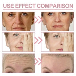 Jaysuing Wrinkle Bounce Multi Balm  Hydrating Moist Skin Fade Out Fine Neck Lines Of The Face Bright Skin